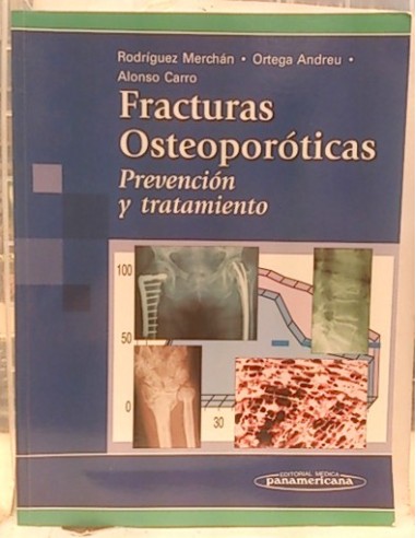 Fracturas Osteoporóticas, Prevención Y Tratamiento